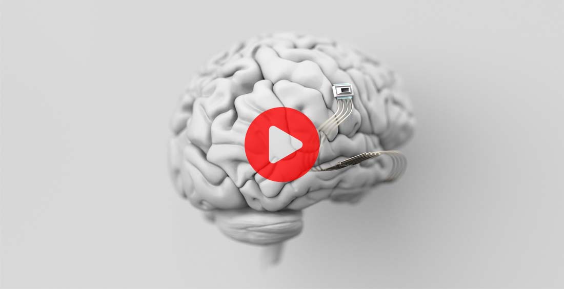 La nueva conciencia digital ¿Cómo revolucionará Neuralink nuestra mente?